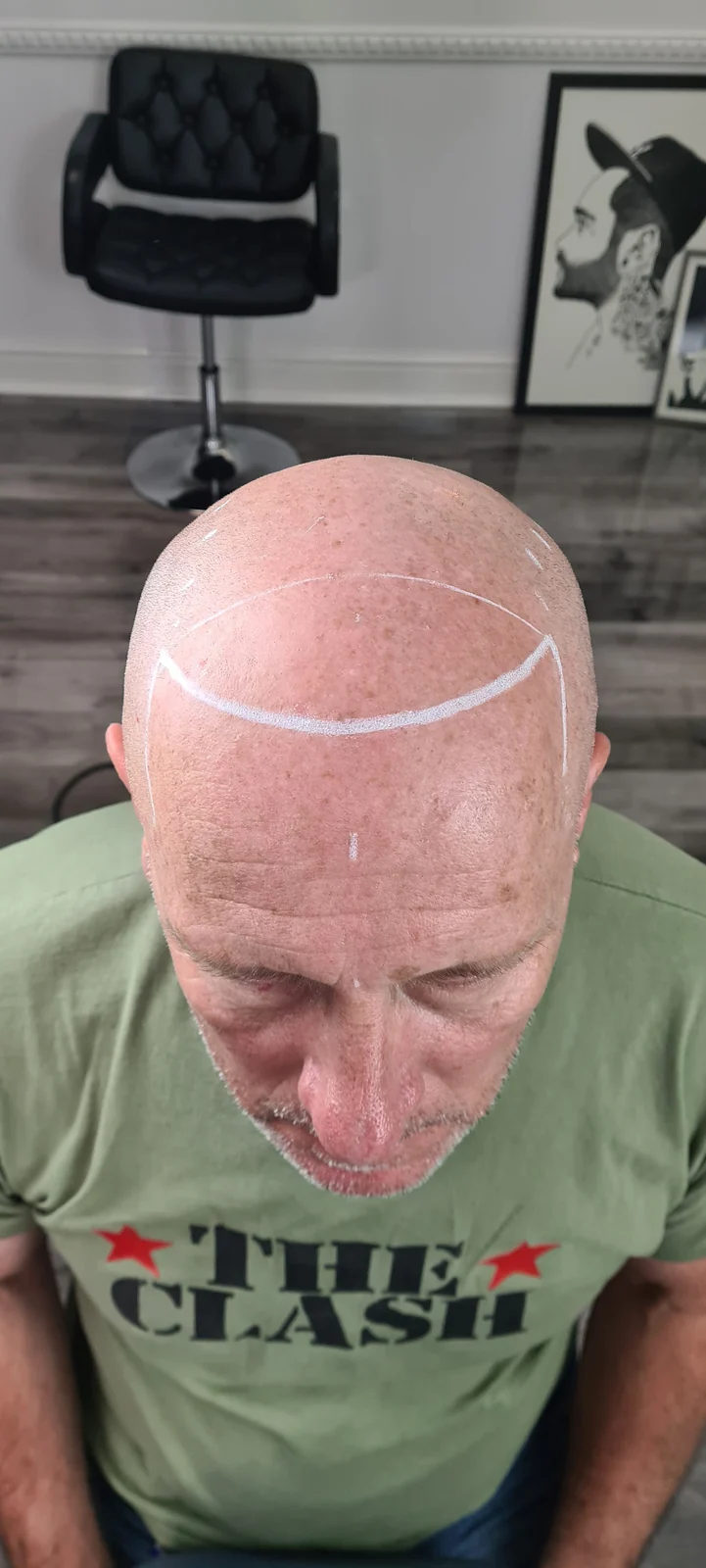 Scalp treatment planning for a previous client